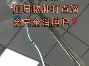 被注射器打辣椒水到屁眼里会有什么后果？如何解决？