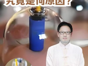 永恒的毁灭之歌：揭秘毁灭公爵罐子拔罐新技巧心得分享