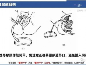 护士 WC 女子撒尿时为何会遇到尴尬？该如何解决？