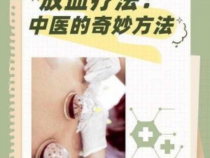 《神医放血疗法：揭秘古老医术的神奇攻略》