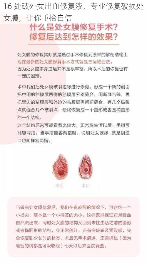 16 处破外女出血修复液，专业修复破损处女膜，让你重拾自信