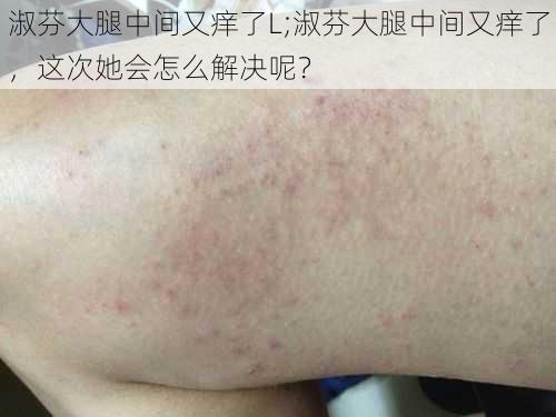 淑芬大腿中间又痒了L;淑芬大腿中间又痒了，这次她会怎么解决呢？