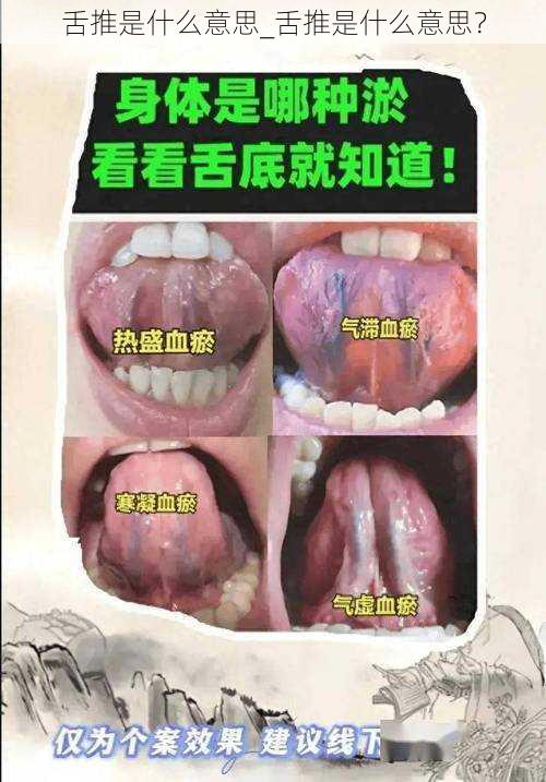 舌推是什么意思_舌推是什么意思？