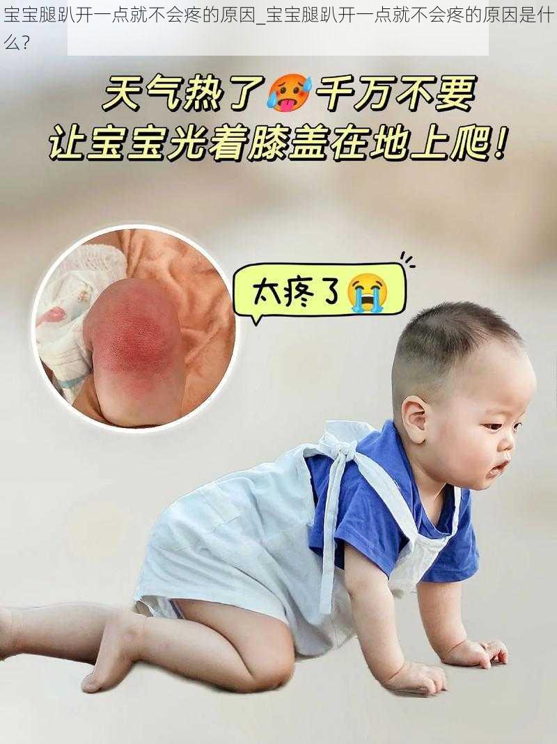 宝宝腿趴开一点就不会疼的原因_宝宝腿趴开一点就不会疼的原因是什么？