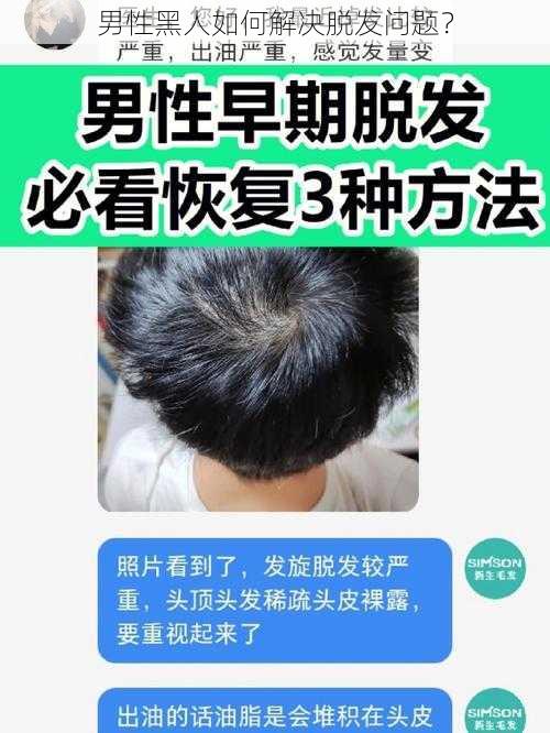 男性黑人如何解决脱发问题？