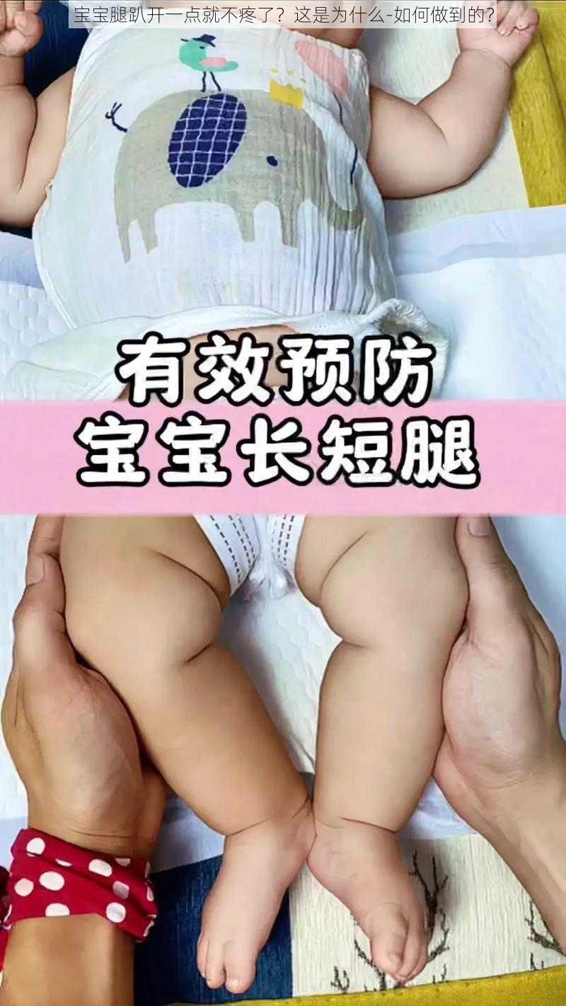 宝宝腿趴开一点就不疼了？这是为什么-如何做到的？