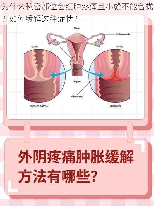 为什么私密部位会红肿疼痛且小缝不能合拢？如何缓解这种症状？